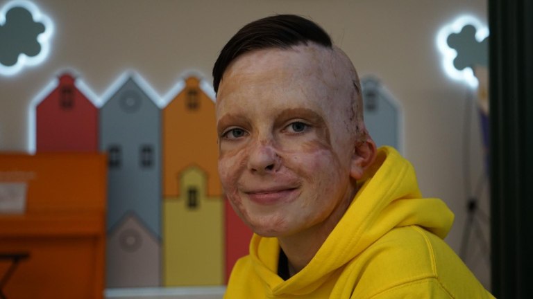 Στρασβούργο: Ο 11χρονος από