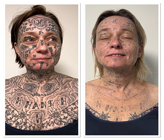Ολλανδία: Έκανε 250 τατουάζ με το όνομά του στο κορμί της συντρόφου του [εικόνες και βίντεο]