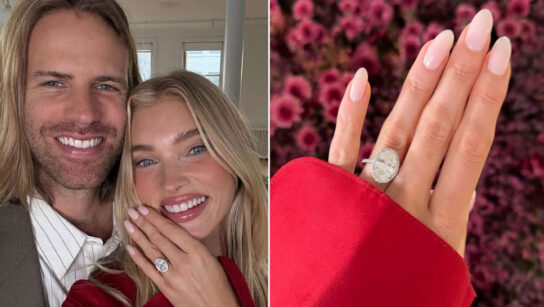 Elsa Hosk Tom Daly: Αρραβωνιάστηκαν