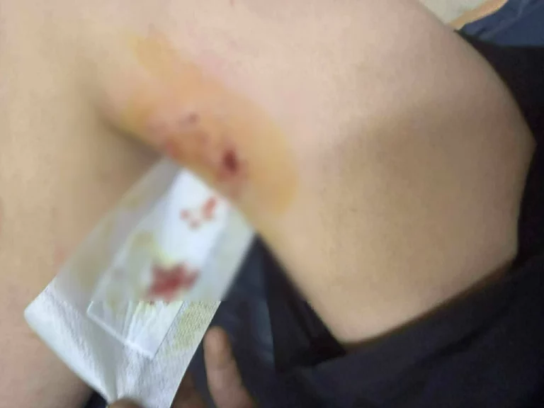 Κρήτη: Άγρια επίθεση σκύλου